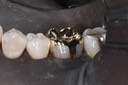Frank Fukuda #19 cementation