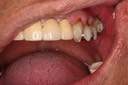 Alan Chinn #12 anterior view