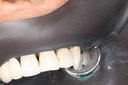 Mendel Sato #3 anterior view