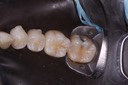 Carla Fukumoto #18 pre-op