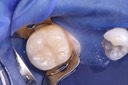 Carl Kobayashi #19 pre-op