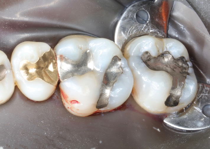 Joe Cha #3 pre-op