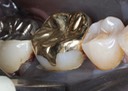 Kris Nip #30 finish buccal
