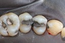Larry Fujioka #12-13 pre-op
