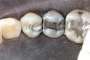 Larry Fujioka #20-21 pre-op