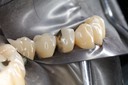 Larry Fujioka #21 finish buccal view