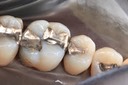 Larry Fujioka #13 - 14 pre-op