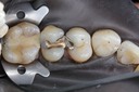 Mark Chun #12-13 pre-op