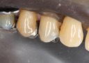 Mark Chun #12 buccal view