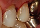 Mark Chun #13 buccal view