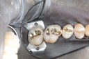 Mark Chun #13,14,15 casting try in