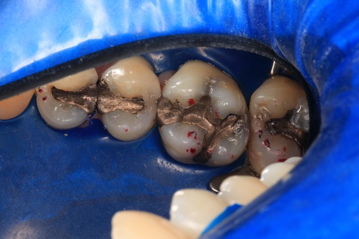 Mark Chun #3 pre-op