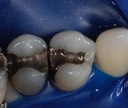 Scott Kanamori #12 pre-op