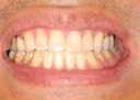 Scott Kanamori #12 smile 2
