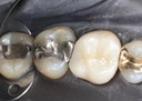 Scott Kanamori #15 pre-op