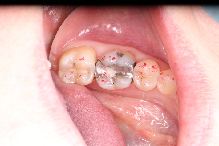 Scott Kanamori #30 pre-op