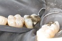 Scott Kanamori #31 finish buccal