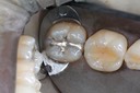 Scott Kanamori #31 pre-op