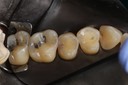 Ted Kanamori #13 pre-op