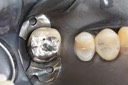 Ted Kanamori #13 pre-op
