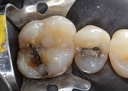 Ted Kanamori #14 pre-op