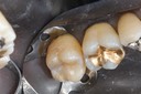 Ted Kanamori #15 pre-op