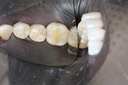 Ted Kanamori #19 pre-op