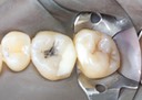 Ted Kanamori #2-3 pre-op