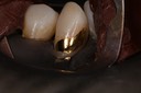 Ted Kanamori #27 finish 1