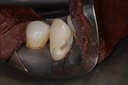 Ted Kanamori #27 prep