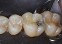 Ted Kanamori #3 pre-op