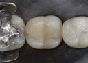 Ted Kanamori #31 pre-op