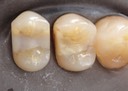 Ted Kanamori #4-5 pre-op 