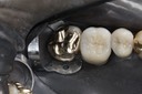 Wayne Chin #15 pre-op
