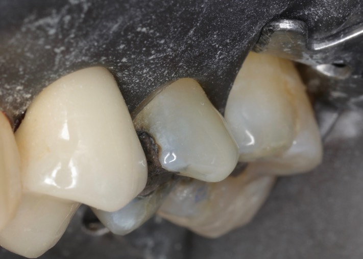 Wes Sato #13 buccal view
