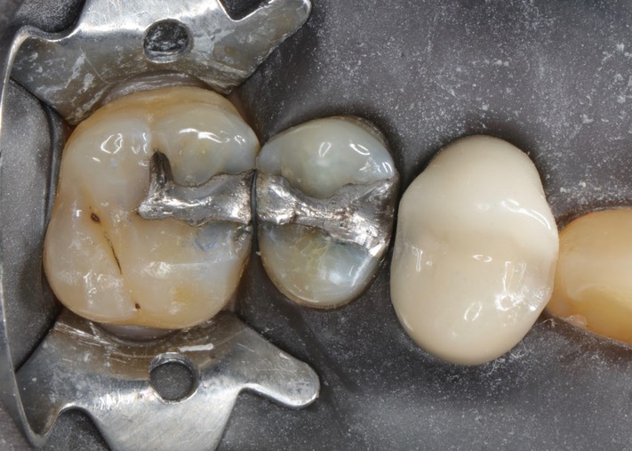 Wes Sato #13 pre-op