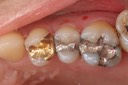 Wes Sato #4 pre-op
