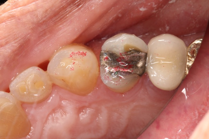 Wes Sato #5 pre-op